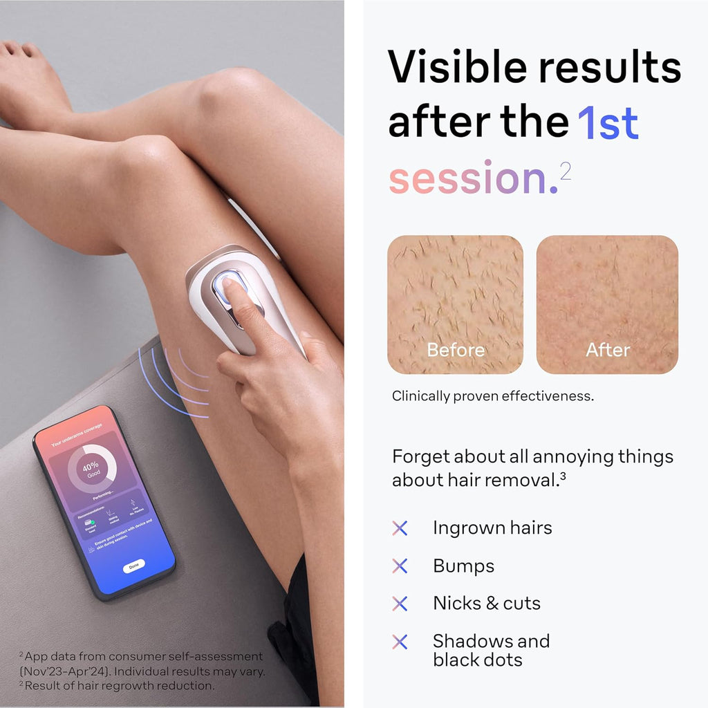 Braun Smart IPL, Skin i·Expert Pro 7, VOGUE's Best Hair Removal Device, IPL Hair Removal for Women and Men, Permanent Laser Hair Reduction At-Home, World's 1st Smart App, 3 Heads, IPL7243